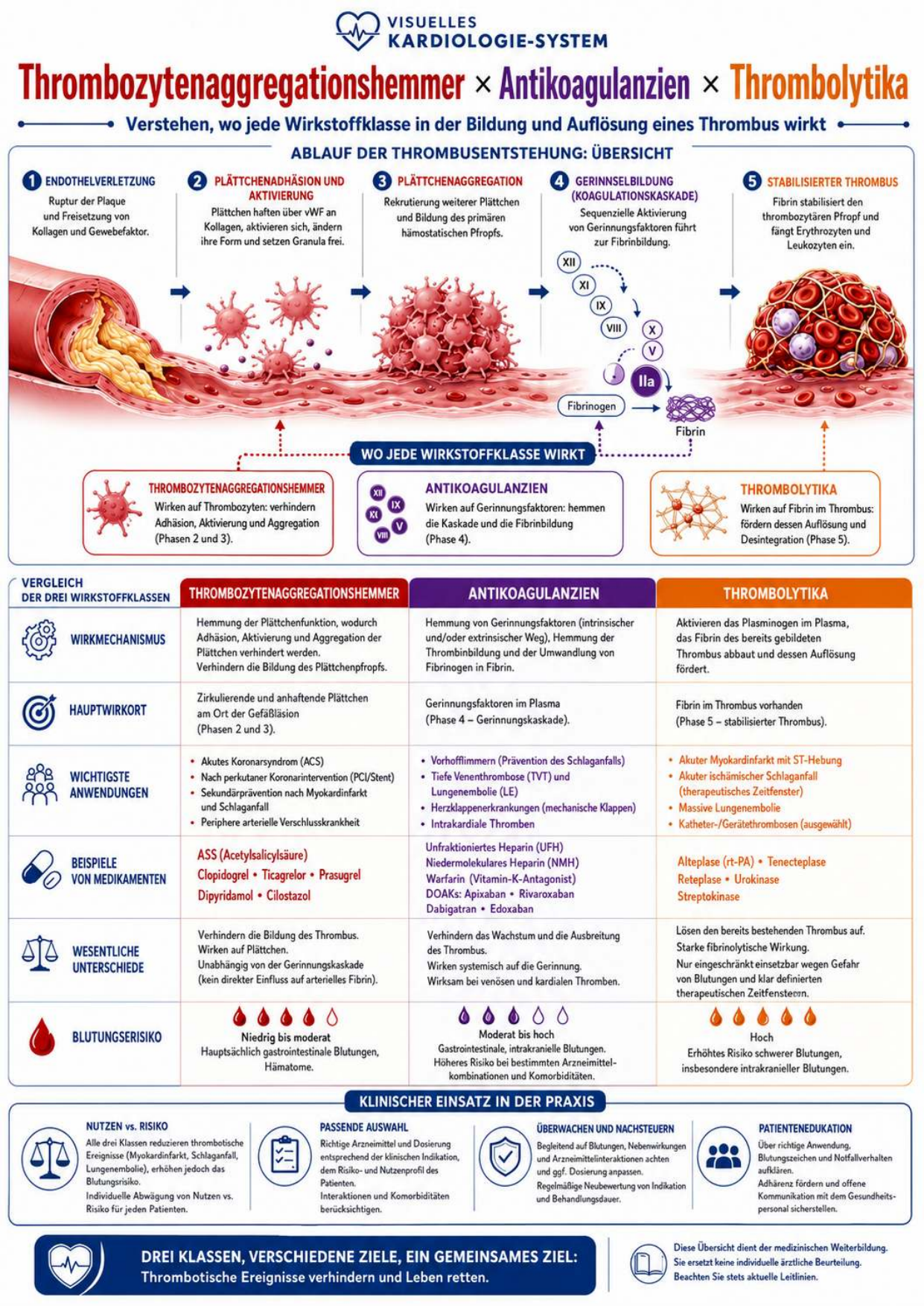 Perikarditis, Perikarderguss und Herzbeuteltamponade